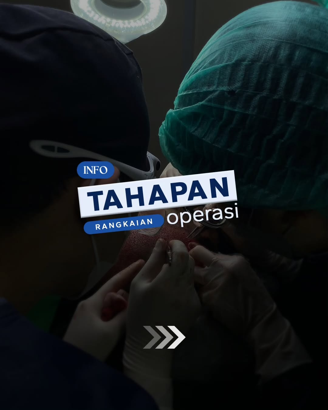 Apakah Hair Transplant permanen?