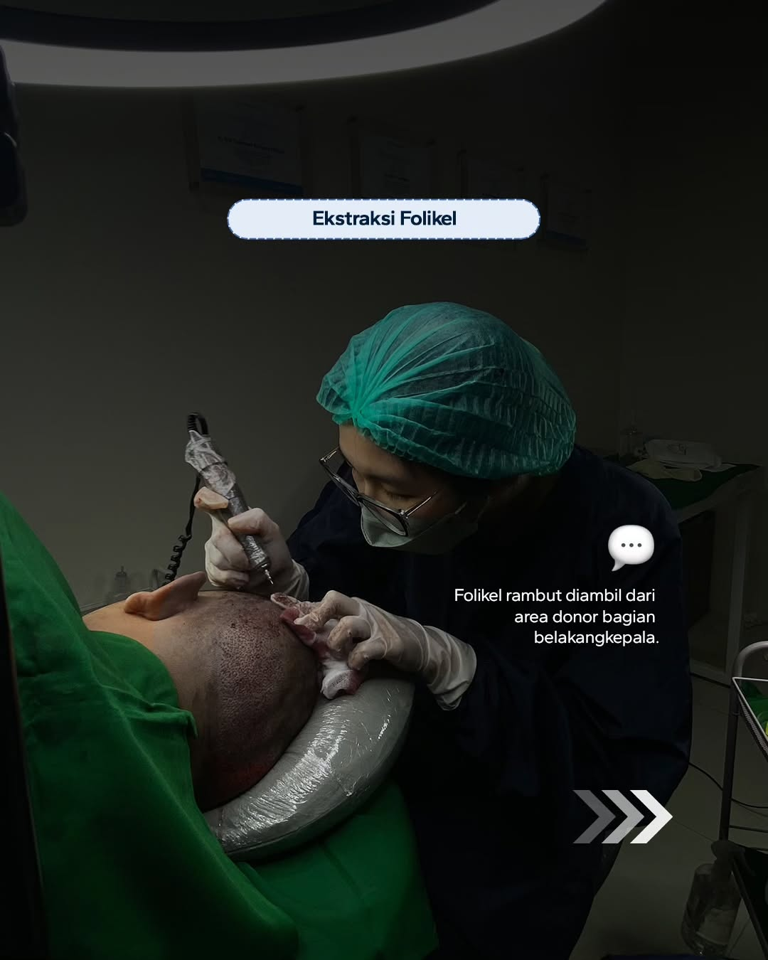 Apakah prosedur Hair Transplant terasa sakit?